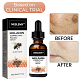 ✨Fast Dark Spot Remover——YIRANTIAN™ Melanin Correcting Facial serum