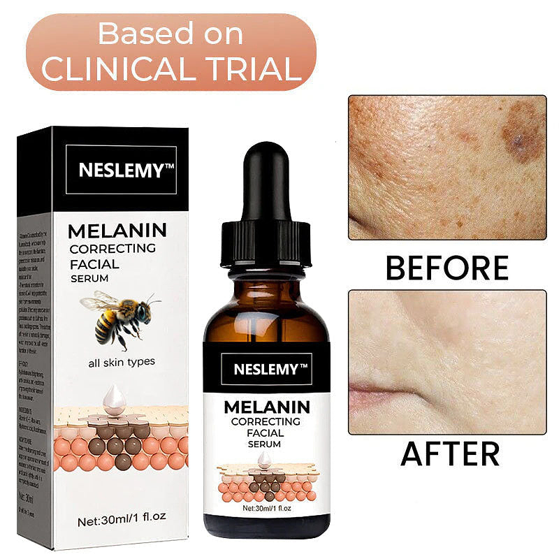 ✨Fast Dark Spot Remover——YIRANTIAN™ Melanin Correcting Facial serum