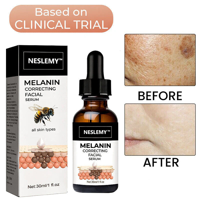 ✨Fast Dark Spot Remover——YIRANTIAN™ Melanin Correcting Facial serum