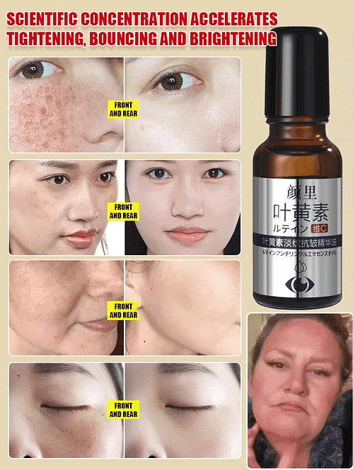 Lutein Anti-Wrinkle Essence Oil
