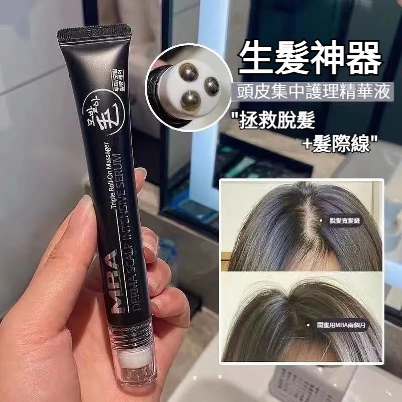 韓國正品MBA滾珠防脫生髮液，生髮增密神器，讓頭髮生長增速40%！濃密度提升2倍！韓國超夯，拯救脫髮+髮際線，天然溫和草本，護理頭皮喚醒毛囊，強韌髮根，不刺激頭皮！無副作用 男女可用