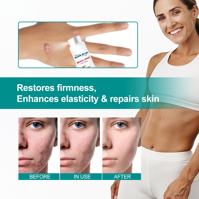 ❤️Advanced Scar Spray For All Types of Scars - For example Acne Scars, Surgical Scars and Stretch Marks ⚡️⚡️⚡️