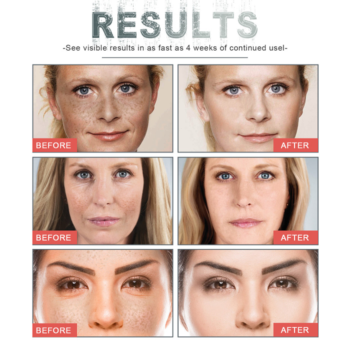 🔥Botox Anti-Aging Serum