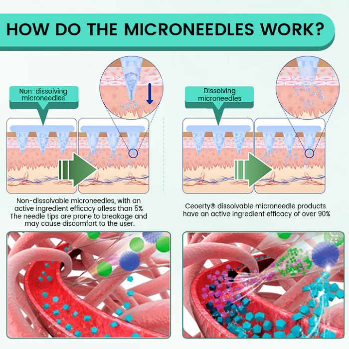 Slimura GLP-1 Nano Microneedle Patch