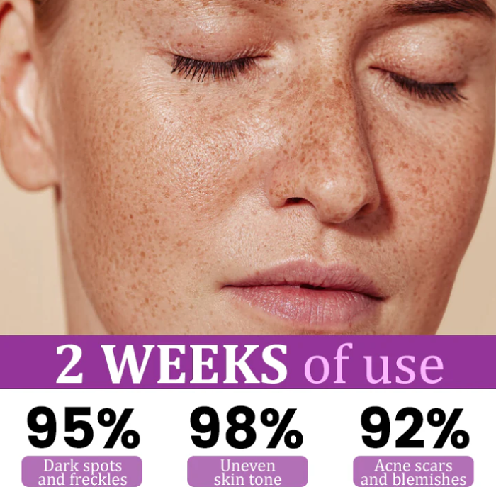 MelantraX Advanced Anti- Hyperpigmentation Essence