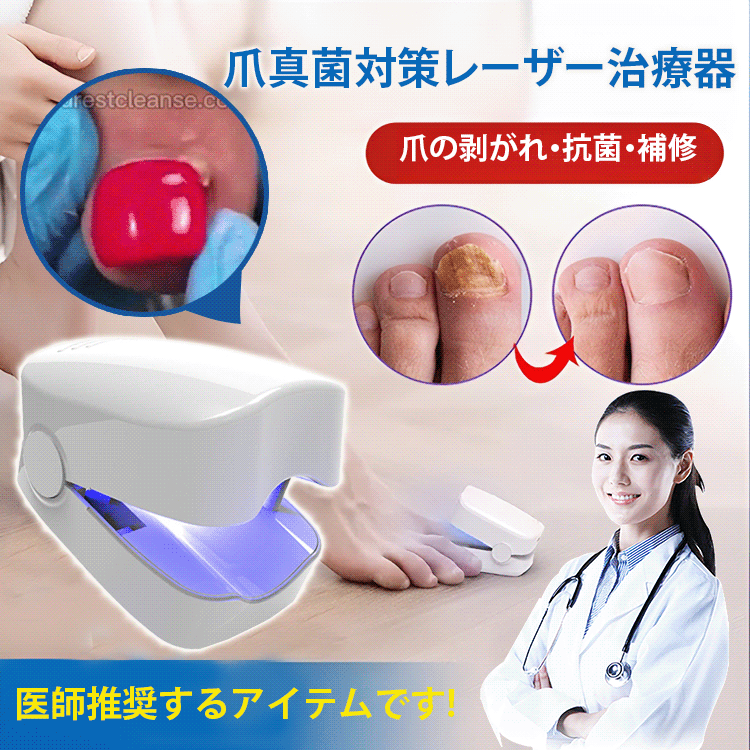 【日本醫師推薦✅藥店熱銷】家用便攜灰指甲甲癬專用激光治療儀