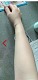 美容外科学会推薦！【男女兼用】スマート無痛脱毛機！脱毛・美肌・黒ずみケア