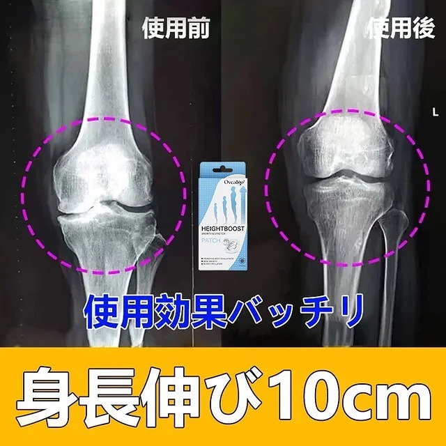 成長の壁を打ち破りたいですか？当社の魔法の成長パッチを試して、無限に成長しましょう！🌱💪
