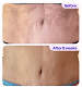 Tighten & Smooth Belly  Cream