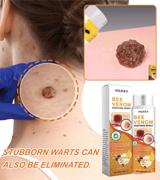 Australia Wart Care Spray