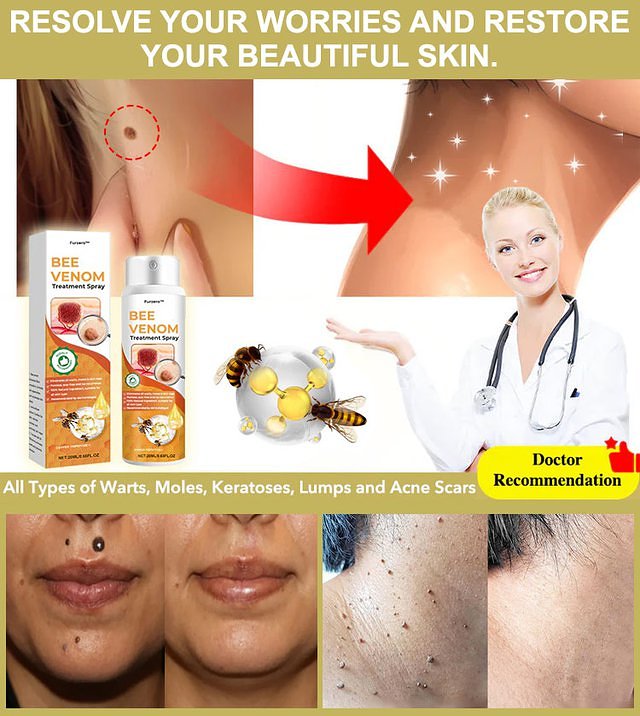 Australia Wart Care Spray