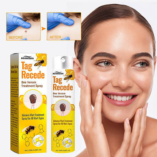 Say goodbye to stubborn warts with BOOMOON Bee Venom Wart Care Spray!