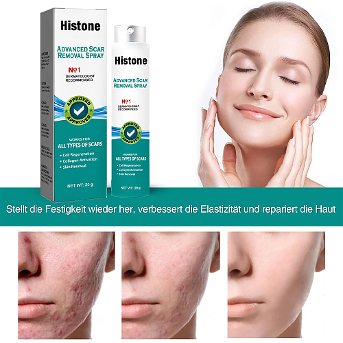 Advanced Scar Spray For All Types of scars -For example Acne Scars, Surgical scars and Stretch Marks