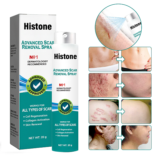 Advanced Scar Spray For All Types of scars -For example Acne Scars, Surgical scars and Stretch Marks