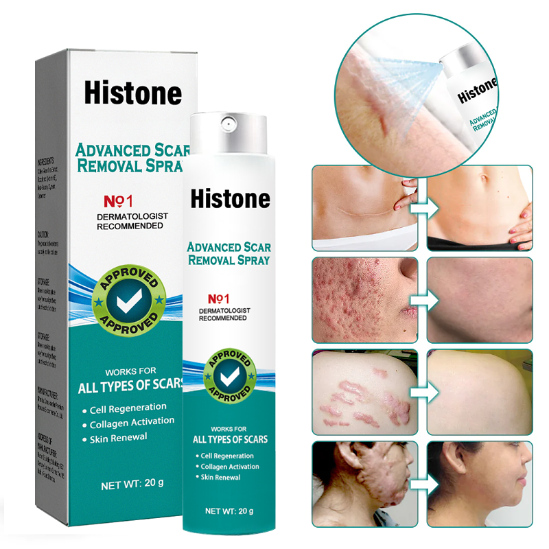 Advanced Scar SprayForAll Types of scars -For example Acne Scars, Surgical scars and StretchMarks