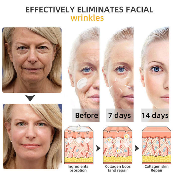 💐🐝Flysmus™ BeeLift Anti-Aging Firming Cream,Address Crepe & Sagging