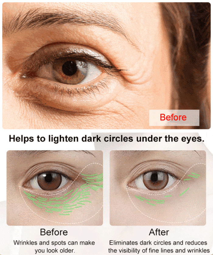 CËLYN Instant FIRMx Eye Tightene