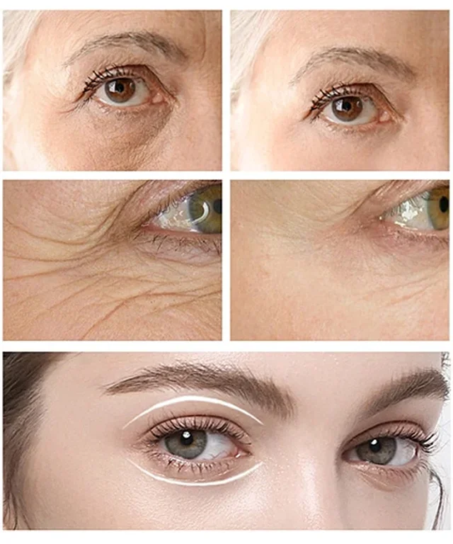 CËLYN Instant FIRMx Eye Tightene