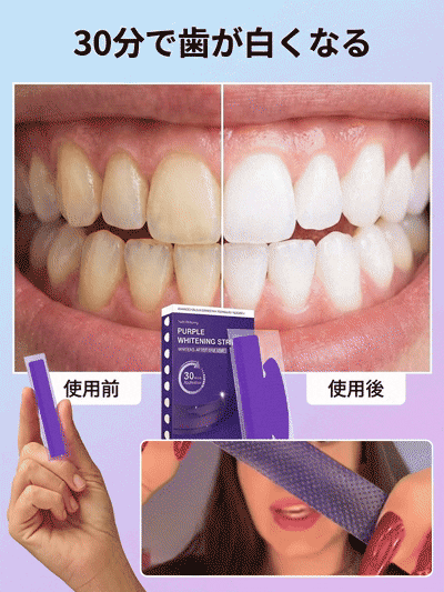V34 Whitening Strips 牙齒美白貼，有效去除牙漬#美白貼片#口腔護理
