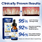  Oral Repair Solution-Targets Receding Gums, Periodontitis & Plaque at the Root Cause