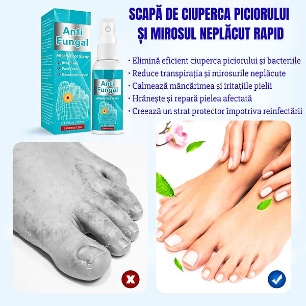 Copy SPRAY FOR FOOT FUNGUS AND UNPLEASANT ODOR