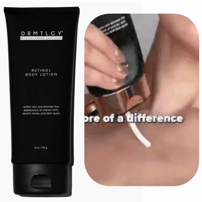 Retinol Body Lotion