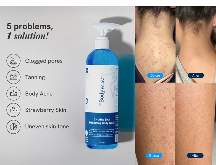 5% AHA BHA Exfoliating Body Wash - 250 mL