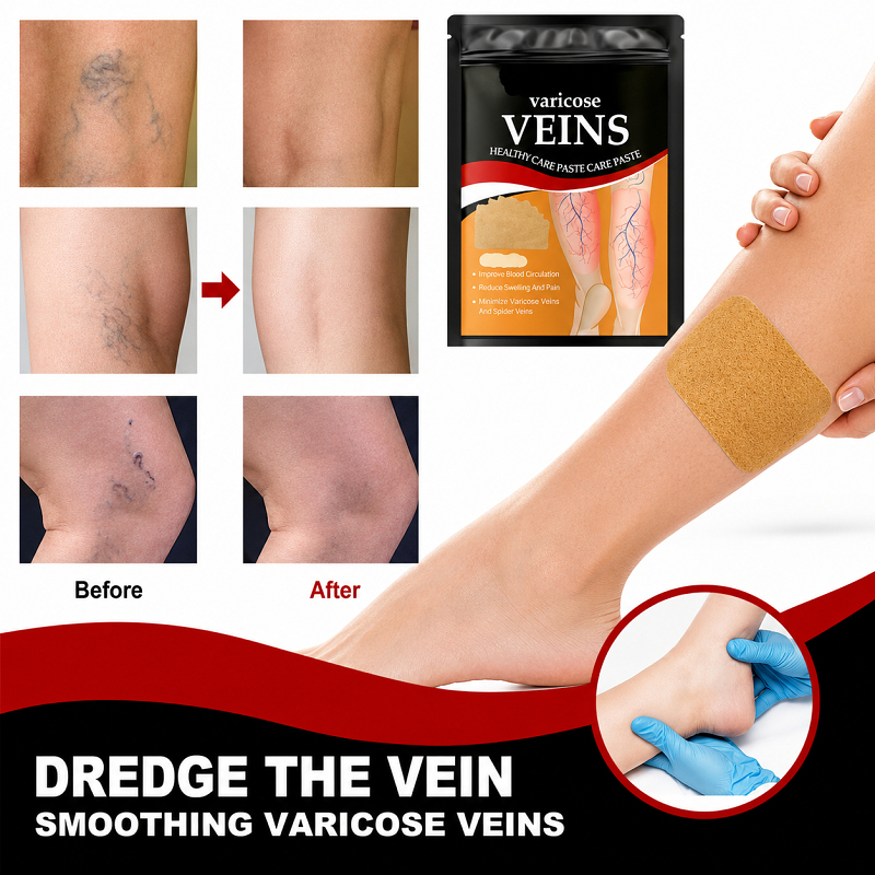 Varicose veins Patch, High-quality Sheet Material ,Set Of 12 Patches