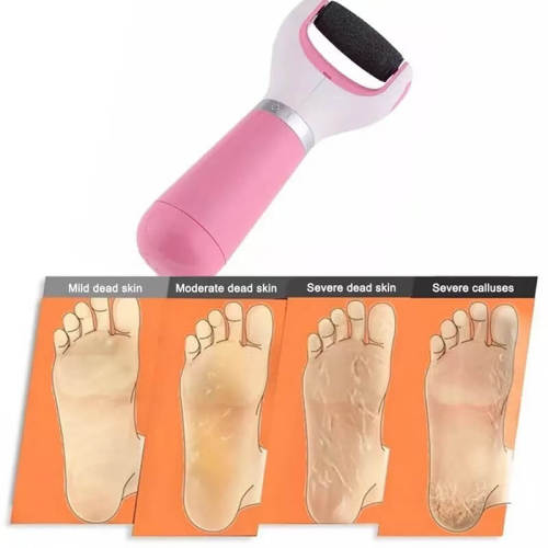 Foot repair tools