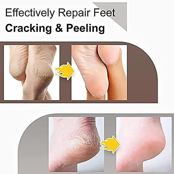 Foot moisturizing anti-cracking cream