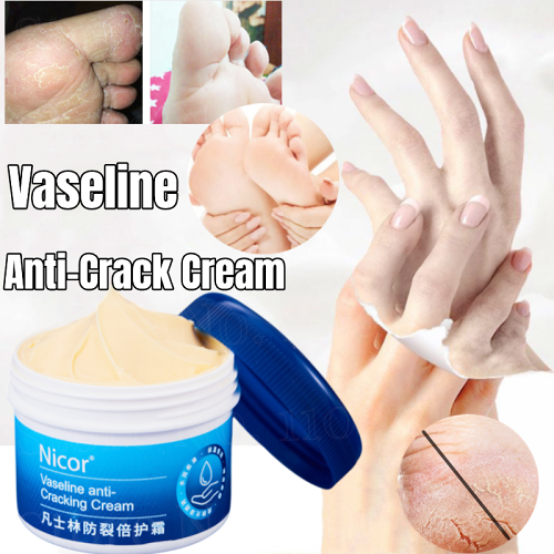 Anti-cracking special cream