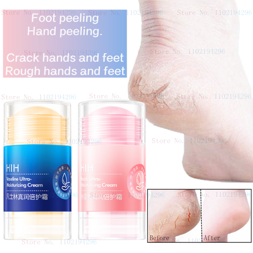 Cracked Foot Cream