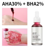 30ml Fruit Acid Face Serum Anti Aging Fade Acne Fades Smooths Lines Brighten Skin Care Essence
