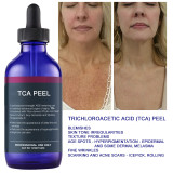 15% Peeling Trichloroacetic Acid TCA Solution Skin Care Chemical Peel Whitening Brightening Pigmentation Serum For Face