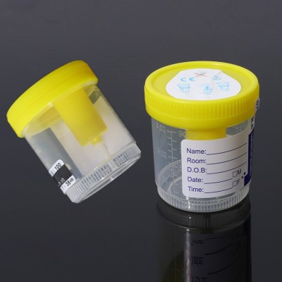 100ml sterile sample container medical urine test cup CE certified