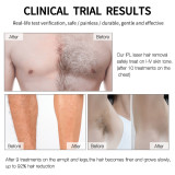 Home Use painless remover permanent  hair trimmer ipl laser hair removal device portable epilator hai removal laser