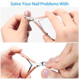 Factory sale ingrown cuticle nail nipper stainless steel