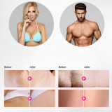 Flashes Epilator IPL Laser Hair Remover Permanent Laser Hair Removal Portable Painless Epilator Bikini Beauty Tools