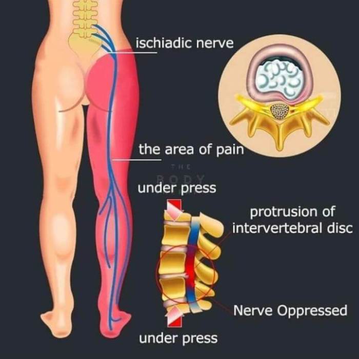 Back Pain Stretch Device