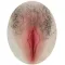 Implanted #1