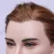 Implant Hair (Implant hair style is same as the model)