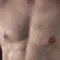 Yes