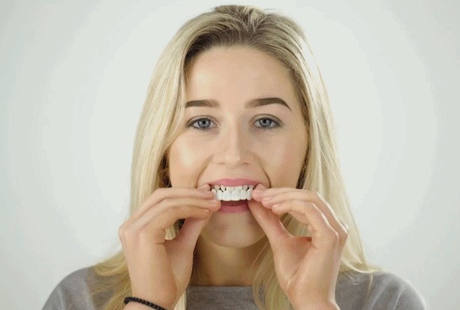 Magic Smile Teeth Brace 【Can eatting】100% non-inductive fit, no foreign body sensation！