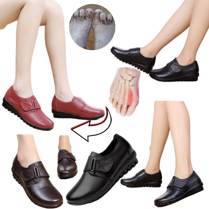 Casual Women's Genuine Leather Shoes for Bunions