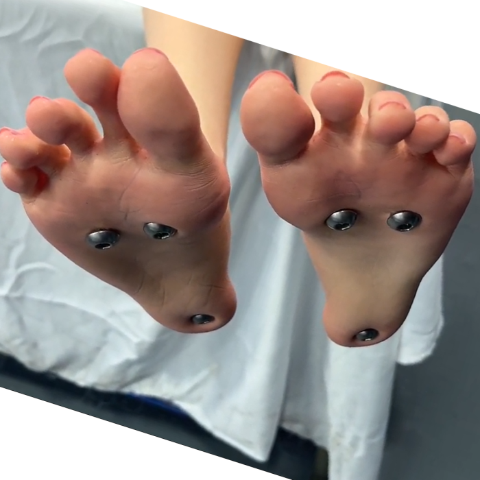 A2: Livi + 22 Body