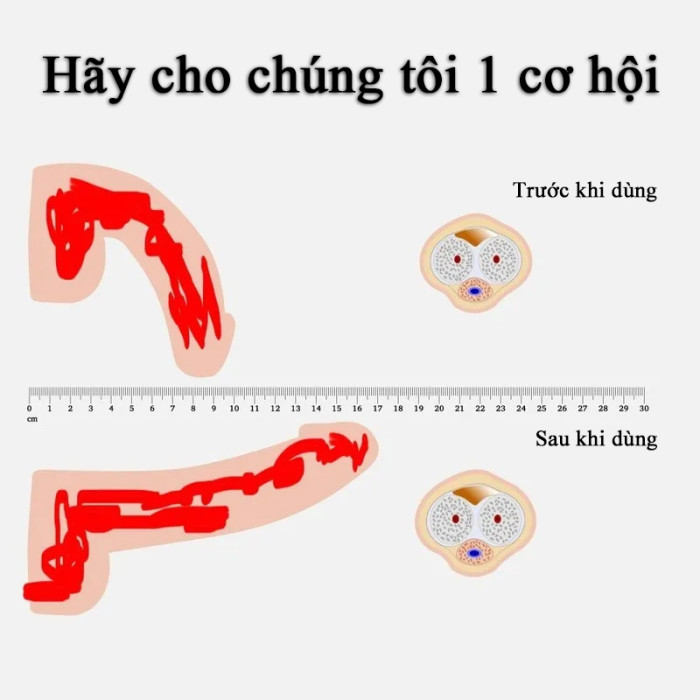 【Nhập khẩu từ Nhật Bản】Nhật Bản PEINEIL nguyên kiện xịt kéo dài thời gian / Được các chuyên gia ngoại khoa nam giới khuyên dùng 【Hỗ trợ kiểm tra hàng trước khi thanh toán / Miễn phí vận chuyển toàn quốc / Không hiệu quả hoàn trả toàn bộ tiền】