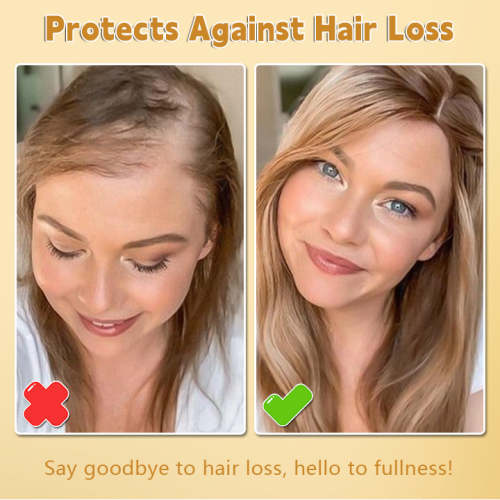Last day to get over 50% off-Tiworld™ Biotin Hair Growth Essence Spray