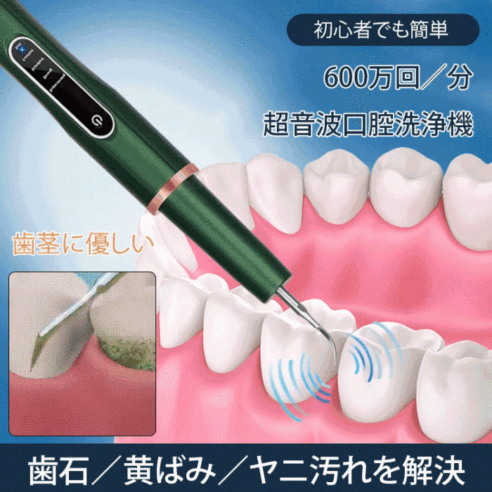 【超音波口腔洗浄機】高周波超音波 電動口腔洗浄機 ディープ洗浄、口腔を守る
