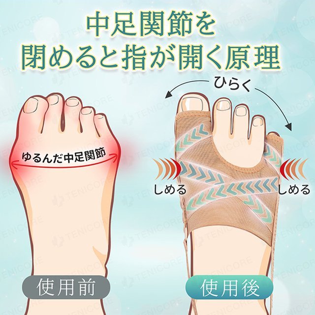 母趾サポーター 外反母趾・O脚・偏平足に悩む方へ